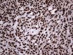 HNRNPL Antibody in Immunohistochemistry (Paraffin) (IHC (P))