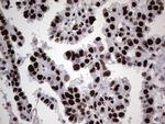 HNRNPL Antibody in Immunohistochemistry (Paraffin) (IHC (P))