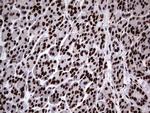 HNRNPL Antibody in Immunohistochemistry (Paraffin) (IHC (P))