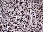 HNRNPL Antibody in Immunohistochemistry (Paraffin) (IHC (P))