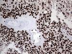 HNRNPL Antibody in Immunohistochemistry (Paraffin) (IHC (P))