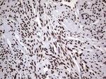 HNRNPL Antibody in Immunohistochemistry (Paraffin) (IHC (P))