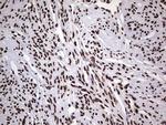 HNRNPL Antibody in Immunohistochemistry (Paraffin) (IHC (P))