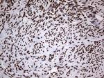 HNRNPL Antibody in Immunohistochemistry (Paraffin) (IHC (P))