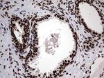 HNRNPL Antibody in Immunohistochemistry (Paraffin) (IHC (P))