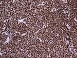 HNRNPL Antibody in Immunohistochemistry (Paraffin) (IHC (P))