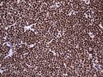 HNRNPL Antibody in Immunohistochemistry (Paraffin) (IHC (P))