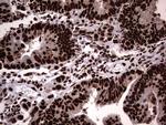 HNRNPL Antibody in Immunohistochemistry (Paraffin) (IHC (P))