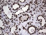 HNRNPL Antibody in Immunohistochemistry (Paraffin) (IHC (P))