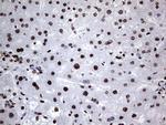 HNRNPL Antibody in Immunohistochemistry (Paraffin) (IHC (P))