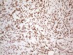 HNRNPL Antibody in Immunohistochemistry (Paraffin) (IHC (P))