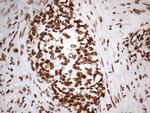 HNRNPL Antibody in Immunohistochemistry (Paraffin) (IHC (P))