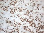 HNRNPL Antibody in Immunohistochemistry (Paraffin) (IHC (P))