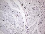 HNRNPL Antibody in Immunohistochemistry (Paraffin) (IHC (P))