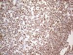 HNRNPL Antibody in Immunohistochemistry (Paraffin) (IHC (P))