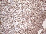 HNRNPL Antibody in Immunohistochemistry (Paraffin) (IHC (P))