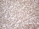 HNRNPL Antibody in Immunohistochemistry (Paraffin) (IHC (P))