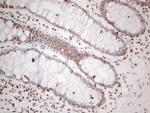 HNRNPL Antibody in Immunohistochemistry (Paraffin) (IHC (P))