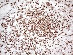 HNRNPL Antibody in Immunohistochemistry (Paraffin) (IHC (P))