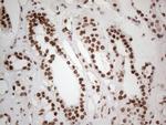 HNRNPL Antibody in Immunohistochemistry (Paraffin) (IHC (P))