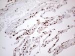 HNRNPL Antibody in Immunohistochemistry (Paraffin) (IHC (P))