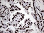 HNRNPL Antibody in Immunohistochemistry (Paraffin) (IHC (P))