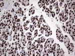 HNRNPL Antibody in Immunohistochemistry (Paraffin) (IHC (P))