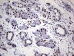 HNRNPL Antibody in Immunohistochemistry (Paraffin) (IHC (P))