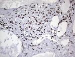 HNRNPL Antibody in Immunohistochemistry (Paraffin) (IHC (P))