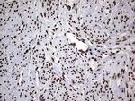 HNRNPL Antibody in Immunohistochemistry (Paraffin) (IHC (P))