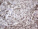 HNRNPL Antibody in Immunohistochemistry (Paraffin) (IHC (P))