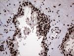 HNRNPL Antibody in Immunohistochemistry (Paraffin) (IHC (P))