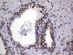 HNRNPL Antibody in Immunohistochemistry (Paraffin) (IHC (P))