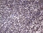 HNRNPL Antibody in Immunohistochemistry (Paraffin) (IHC (P))