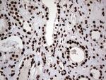 HNRNPL Antibody in Immunohistochemistry (Paraffin) (IHC (P))