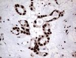 HNRNPL Antibody in Immunohistochemistry (Paraffin) (IHC (P))