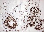 HNRNPM Antibody in Immunohistochemistry (Paraffin) (IHC (P))