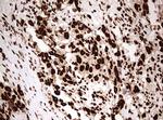 HNRNPM Antibody in Immunohistochemistry (Paraffin) (IHC (P))