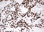 HNRNPM Antibody in Immunohistochemistry (Paraffin) (IHC (P))