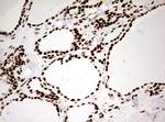 HNRNPM Antibody in Immunohistochemistry (Paraffin) (IHC (P))