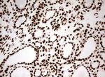 HNRNPM Antibody in Immunohistochemistry (Paraffin) (IHC (P))