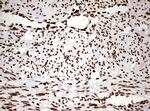 HNRNPM Antibody in Immunohistochemistry (Paraffin) (IHC (P))