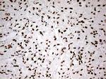 HNRNPM Antibody in Immunohistochemistry (Paraffin) (IHC (P))