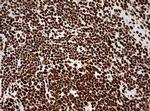 HNRNPM Antibody in Immunohistochemistry (Paraffin) (IHC (P))