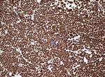 HNRNPM Antibody in Immunohistochemistry (Paraffin) (IHC (P))