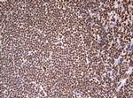 HNRNPM Antibody in Immunohistochemistry (Paraffin) (IHC (P))