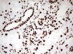 HNRNPM Antibody in Immunohistochemistry (Paraffin) (IHC (P))