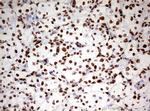 HNRNPM Antibody in Immunohistochemistry (Paraffin) (IHC (P))