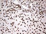 HNRNPM Antibody in Immunohistochemistry (Paraffin) (IHC (P))