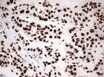 HNRNPM Antibody in Immunohistochemistry (Paraffin) (IHC (P))